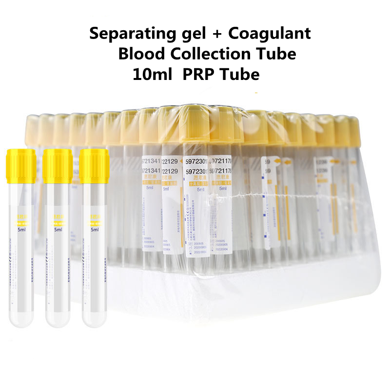 Medical Lab Blood Test - Tubo de recolección de sangre al