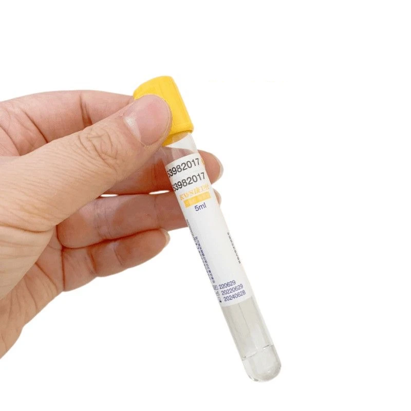 Tubo de recolección de sangre  - Medical Lab Blood Test reseña y precio